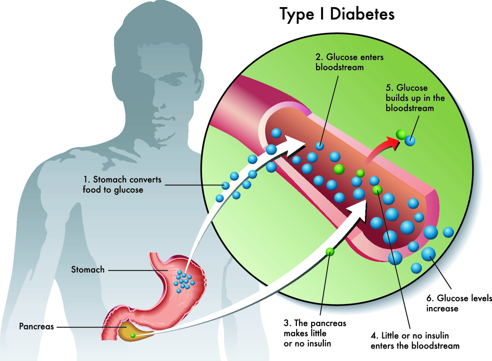 Popular Pesticide That Was Recently Banned Associated With Type 2 Diabetes