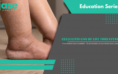 Cellulitis can be Life Threatening