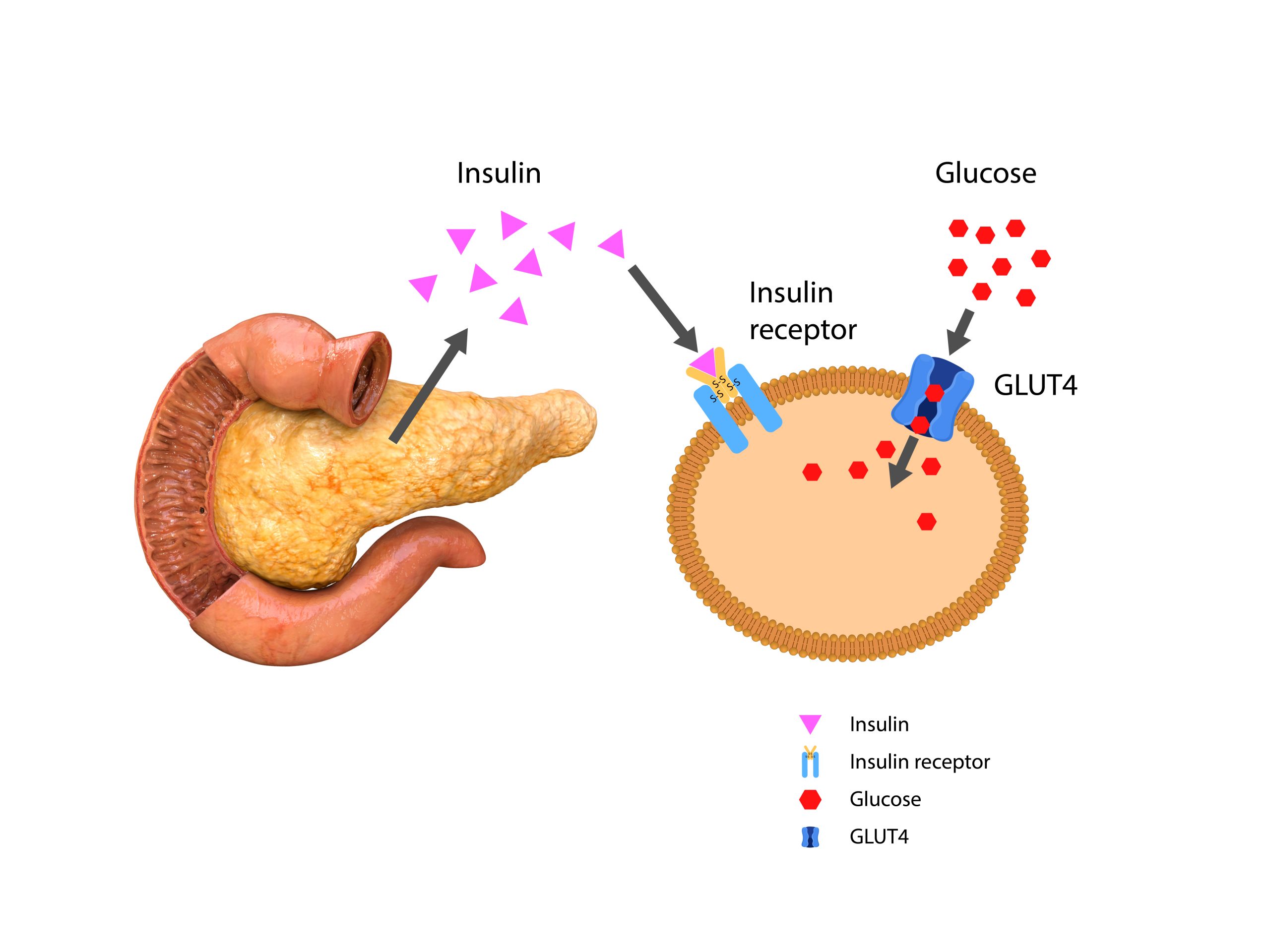 What is Insulin Resistance?