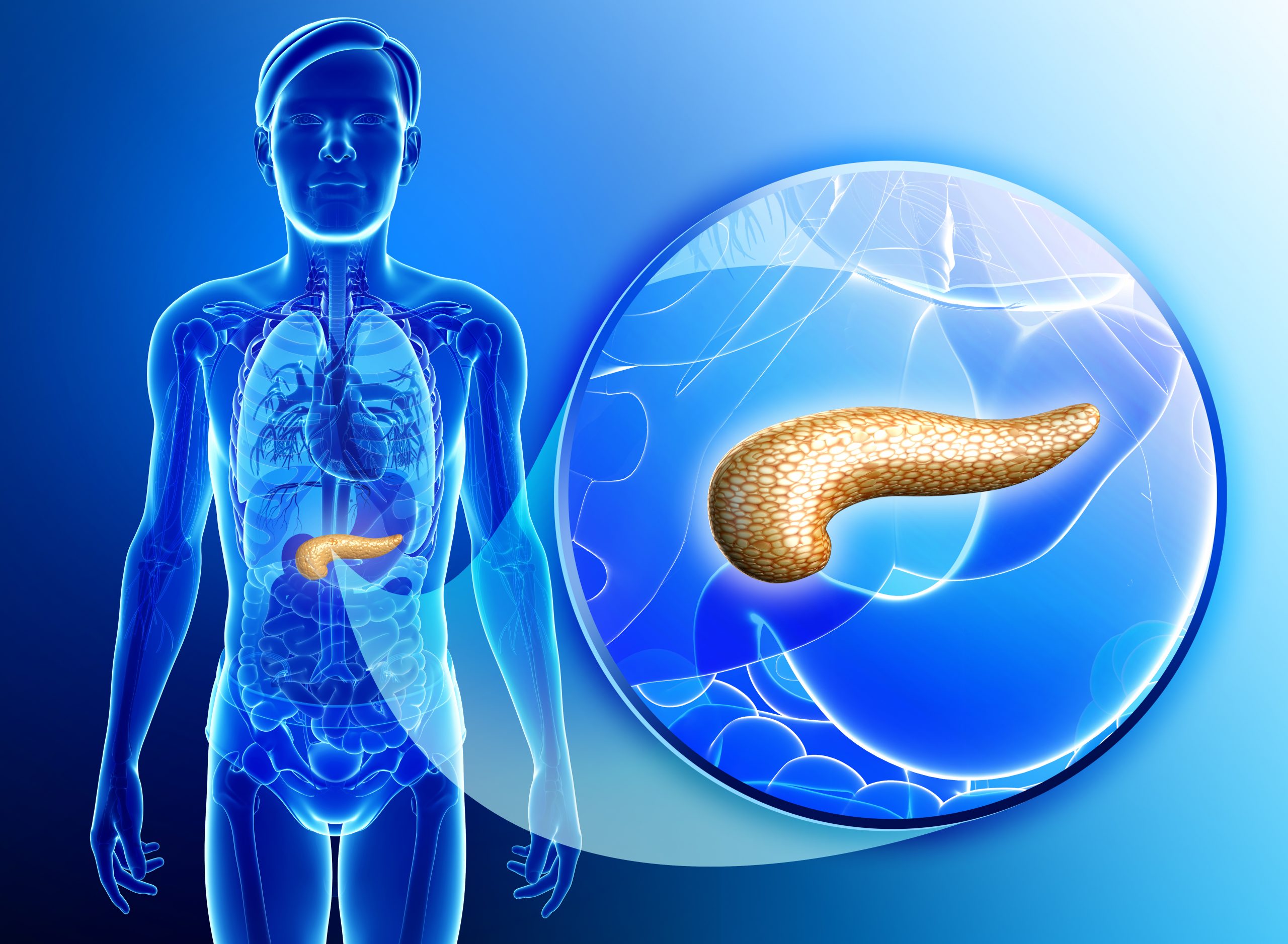 What is Insulin Resistance?